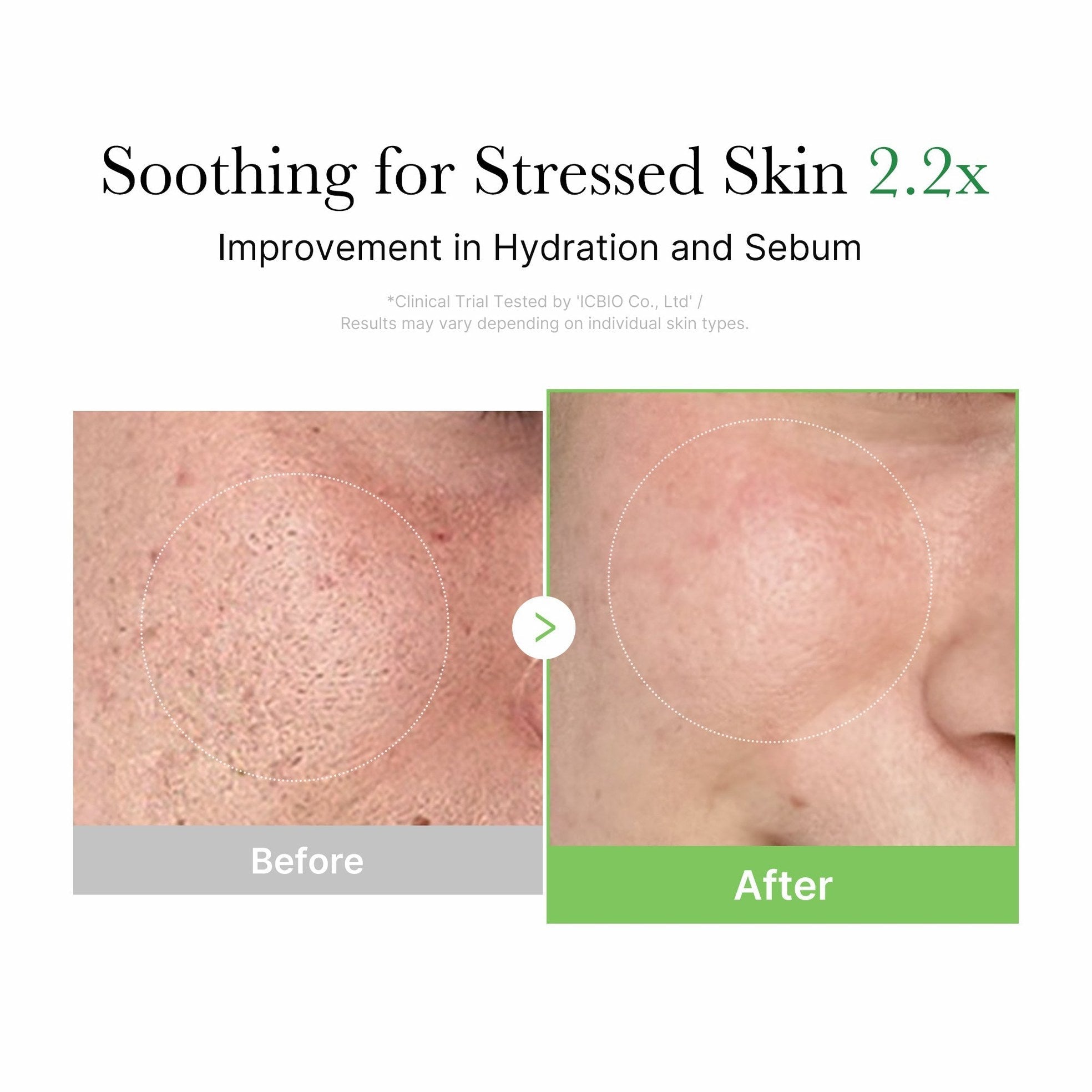 Exosome Cica Calming Cream - Medicube