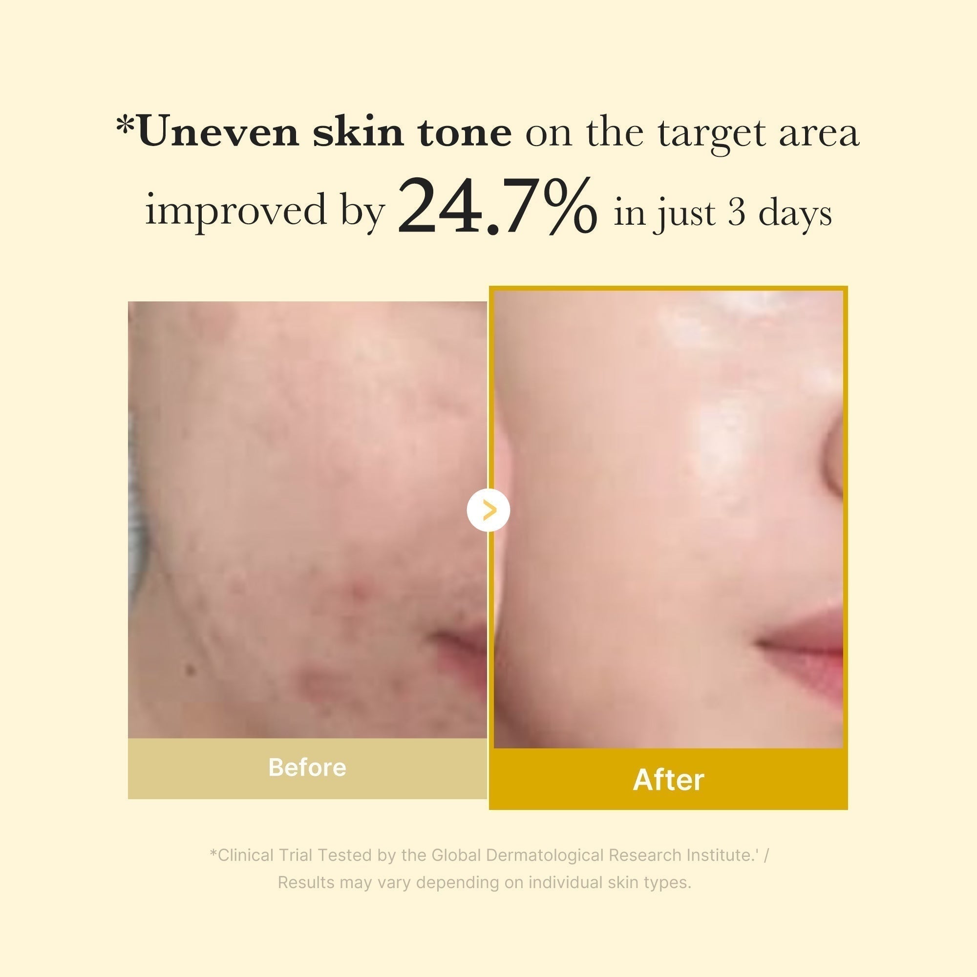 Kojic Turmeric Clarity Set - Medicube